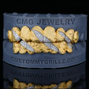 Textured gold-tone grillz with clear stone claw-mark details.