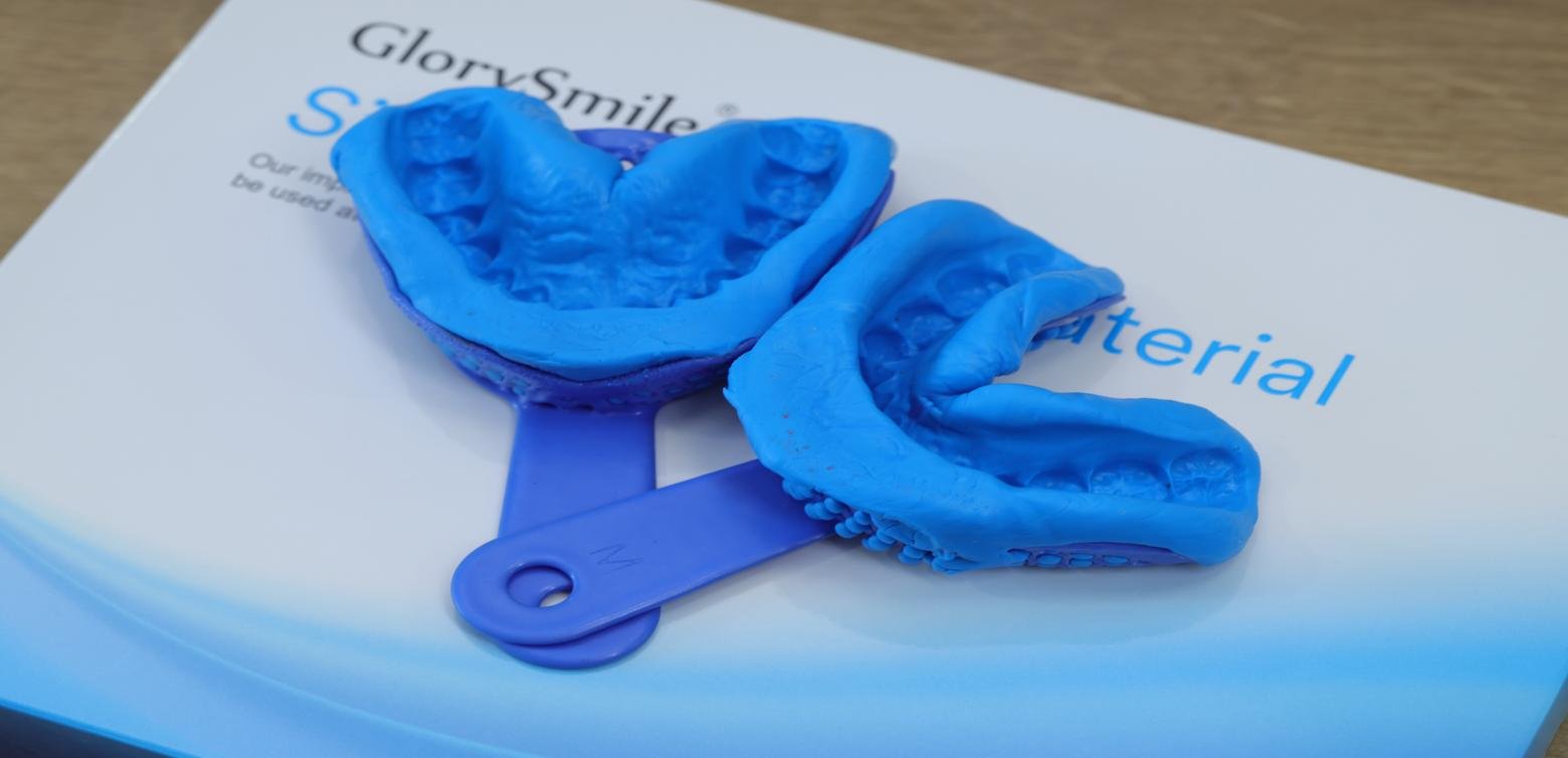 Completed upper and lower dental impressions