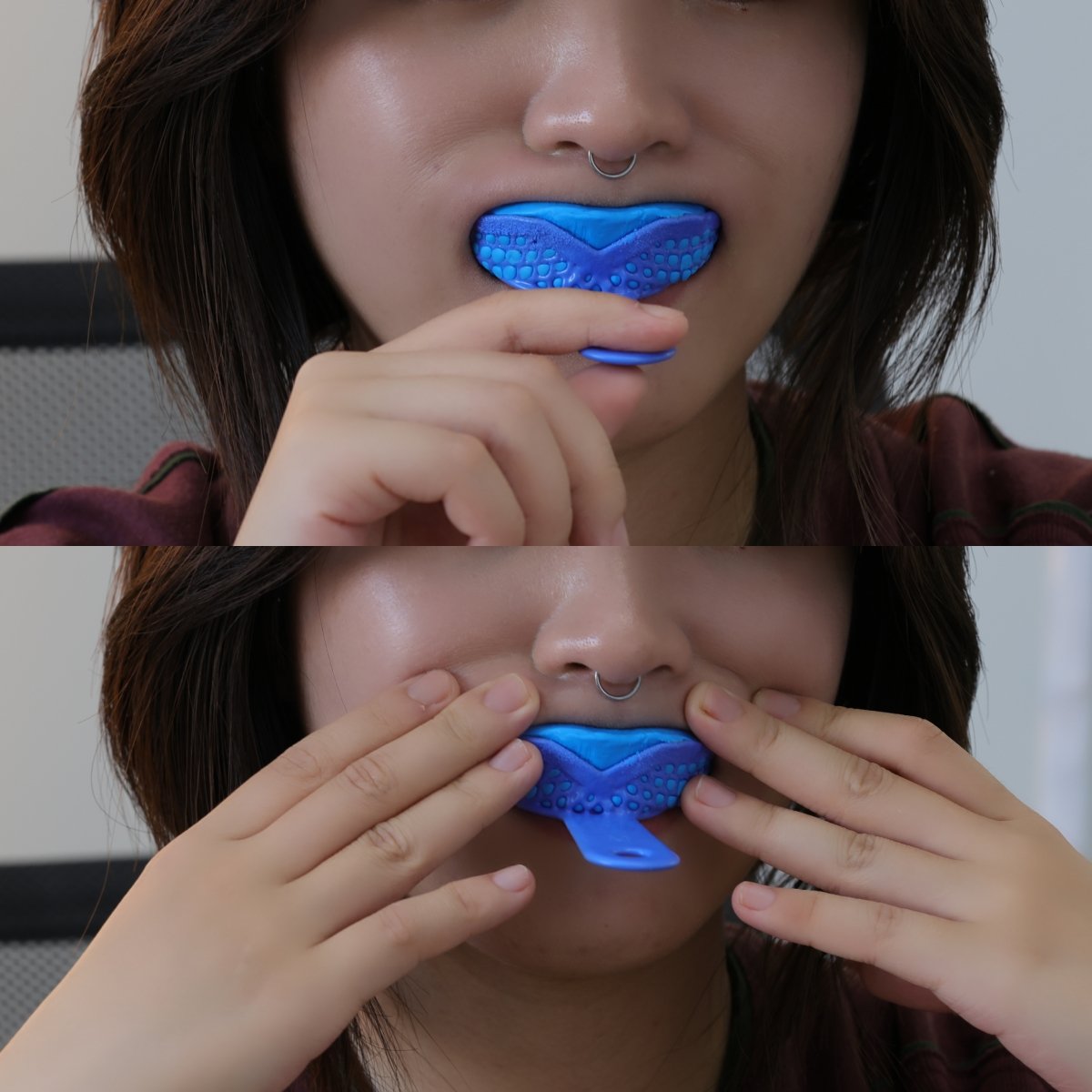 Taking a dental impression