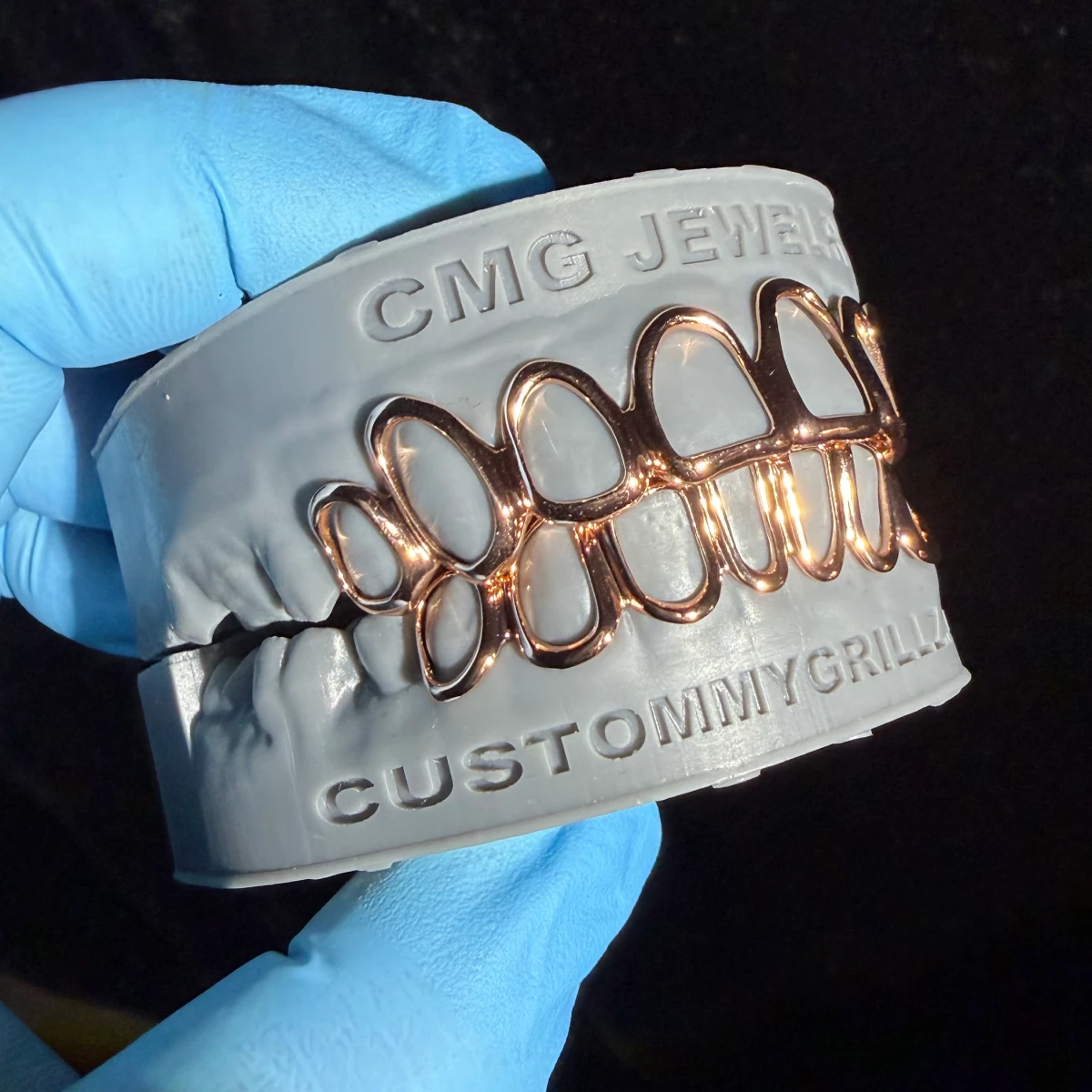 Open Face Rose Gold Grillz - Image 4